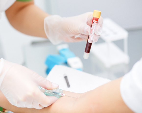 Накопительная скидка на медицинские анализы